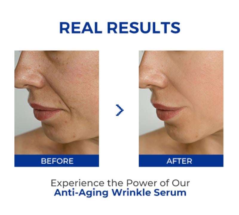 🎉Buy One Get One Free🎁 - Anti-Aging Wrinkle Serum