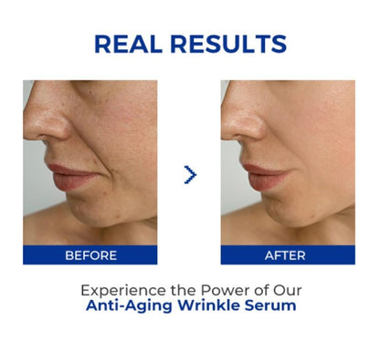 🎉Buy One Get One Free🎁 - Anti-Aging Wrinkle Serum